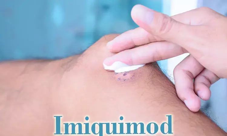 Month long treatment with Imiquimod may induce regression of lentigo maligna melanoma