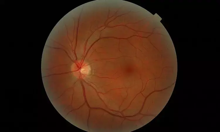High BP and  obesity have  synergistic adverse effects on retinal vasculature in kids: Study