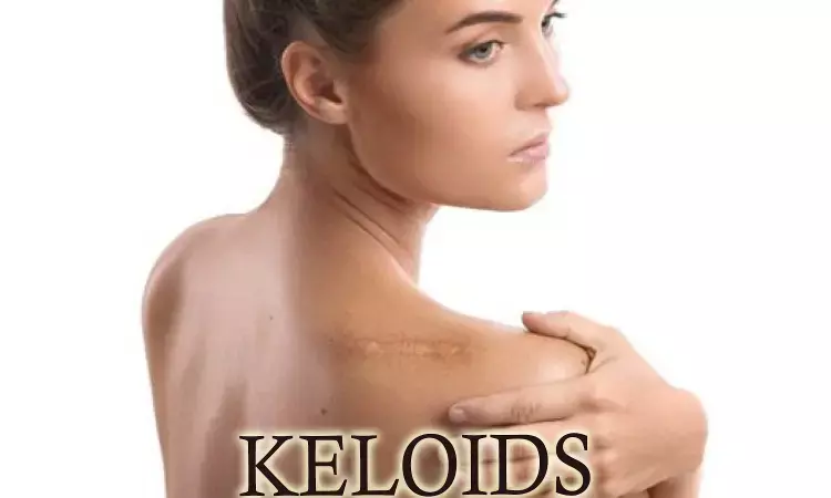 Lack of evidence against efficacy of Silicone gel sheets for keloids