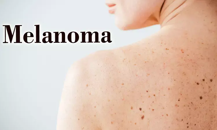 Vitamin D deficiency linked to worse overall survival in melanoma patients