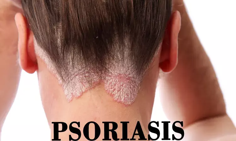 Targeting type I interferons may control inflammation in psoriasis patients: Study