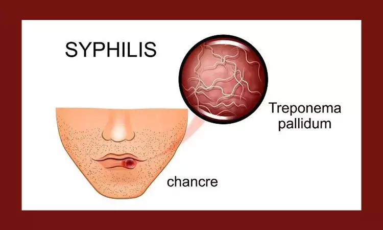 Screening for Syphilis must for individuals who are at high risk: USPSTF reaffirms