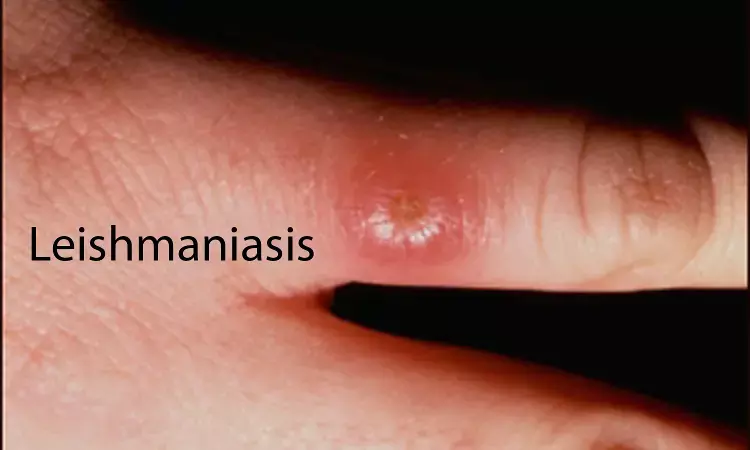 Peptides+antibiotic Combo more effective treatment option for leishmaniasis