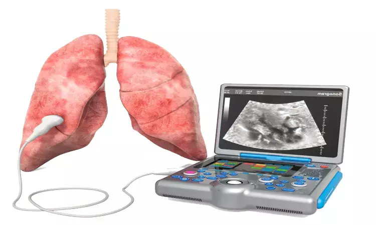 New Ultrasound technique may precisely assess pulmonary fibrosis and pulmonary edema