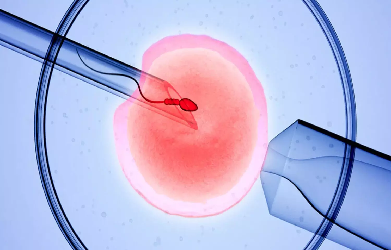 Lower chance of pregnancy and childbirth after IVF with one ovary