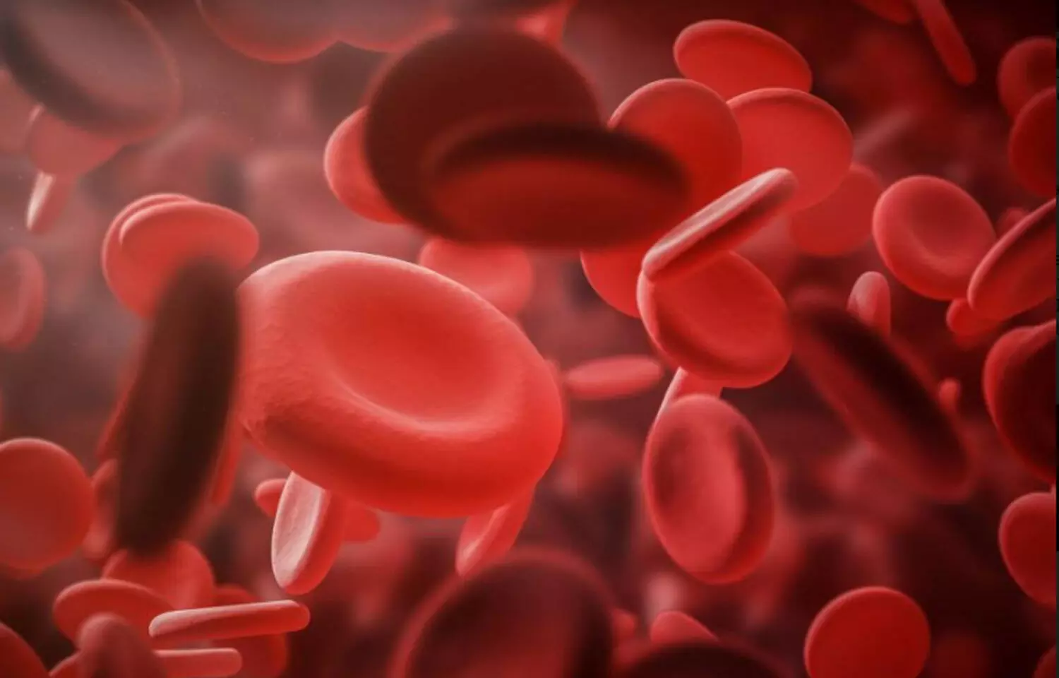 Covid-19 patients with existing Hemoglobinopathy may have more complications