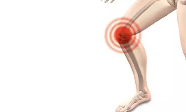Methotrexate may improve knee function in OA when other drugs fail: Study