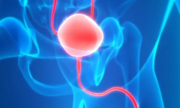 Nephroscopy versus cystoscopy for bladder stones significantly lowers operative time: Study