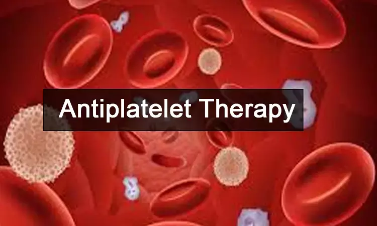 Prior antiplatelet therapy tied to adverse outcomes in intracerebral hemorrhage: Study