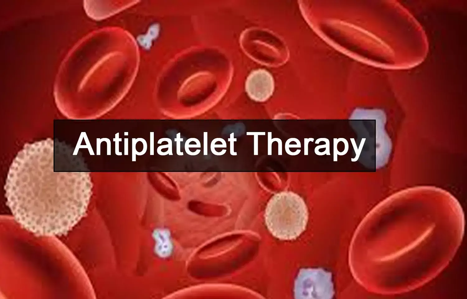 Antiplatelet medicine may have potential as low-cost treatment for heart failure: Study