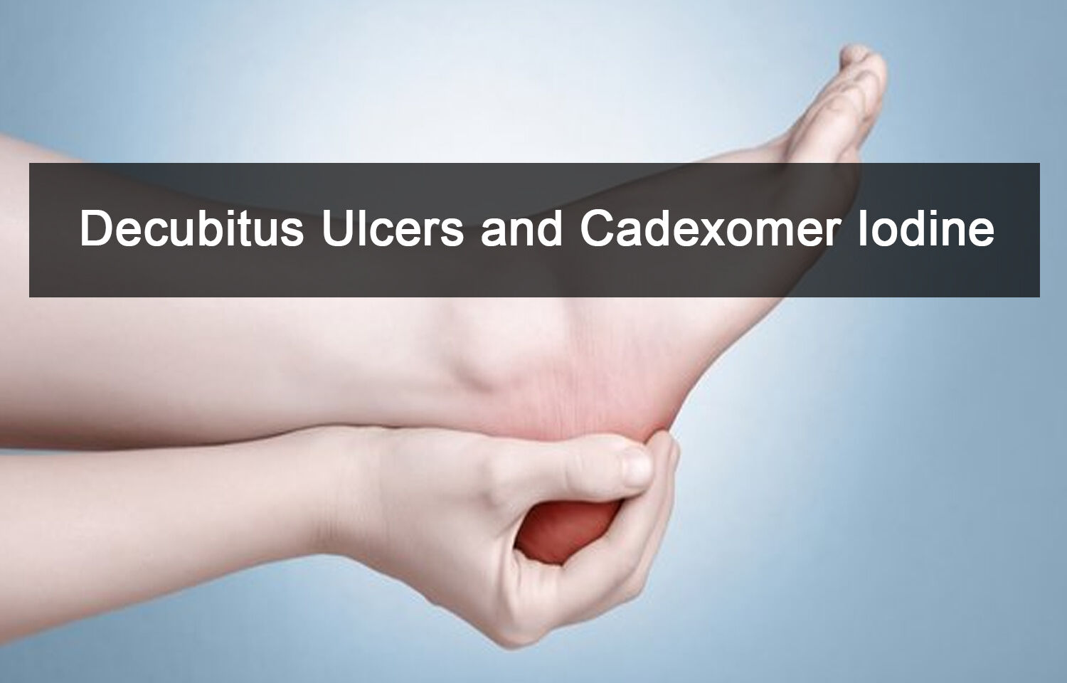 Role Of Cadexomer Iodine In Decubitus Ulcers Review