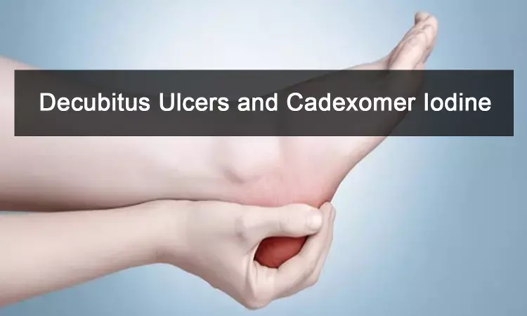 Role of Cadexomer iodine in Decubitus ulcers: Review