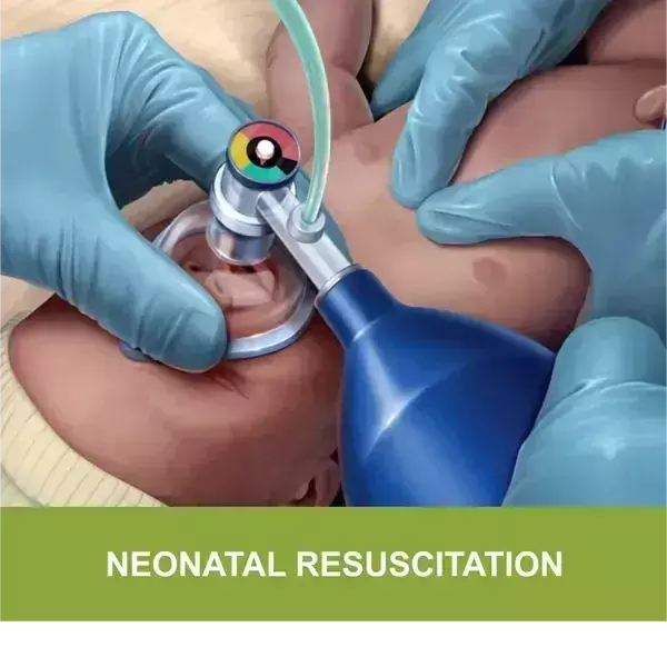 Clinical practice guidelines on neonatal resuscitation: AHA