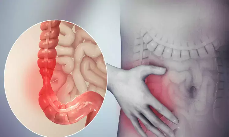 New treatment in development for irritable bowel syndrome with constipation