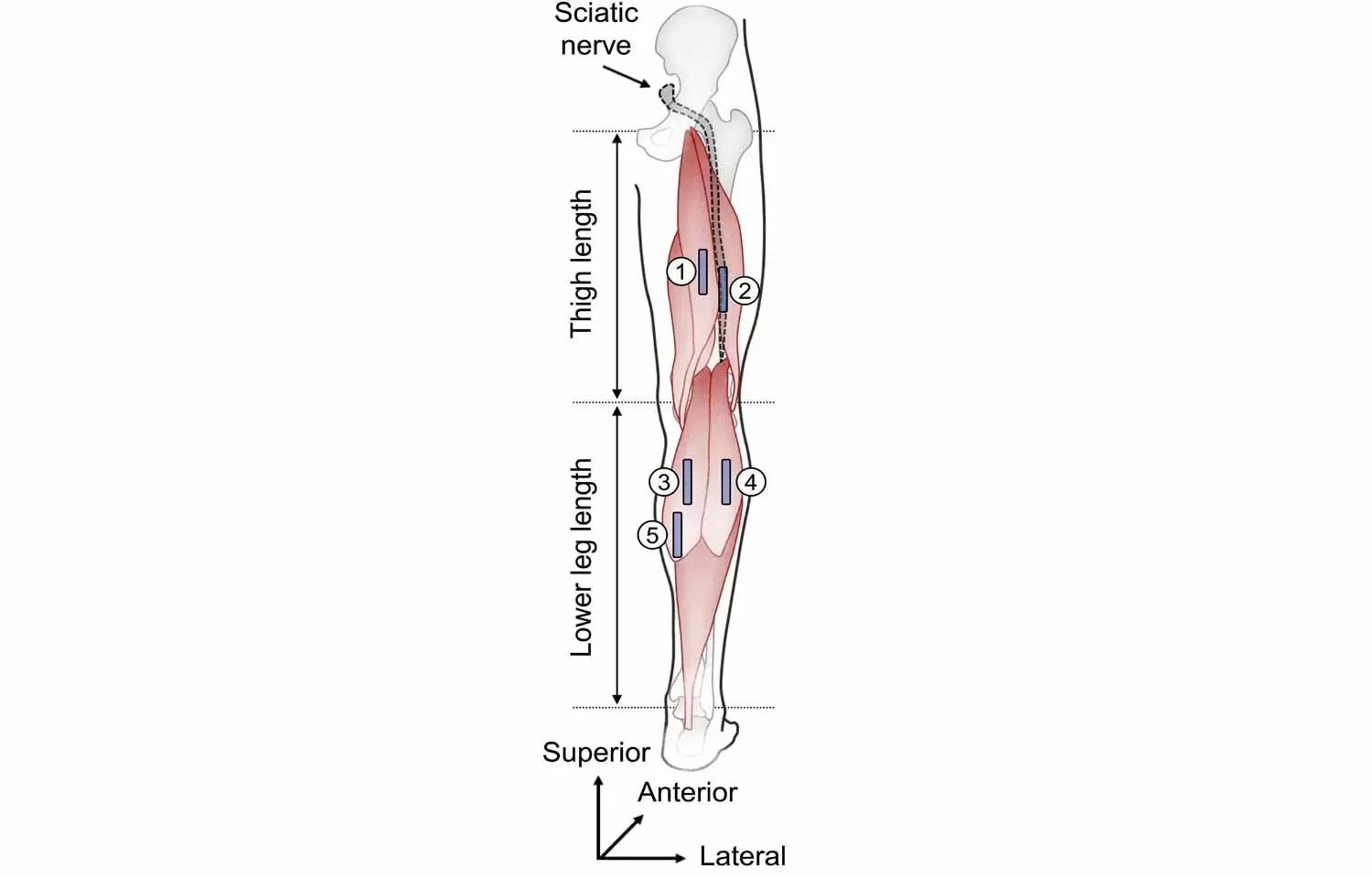 Age not just a number: Causes of joint stiffness differ between older and younger adults