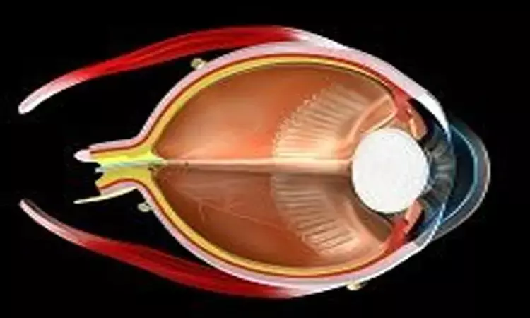 Intravitreal Dexamethasone implant effective for postoperative macular oedema: Study