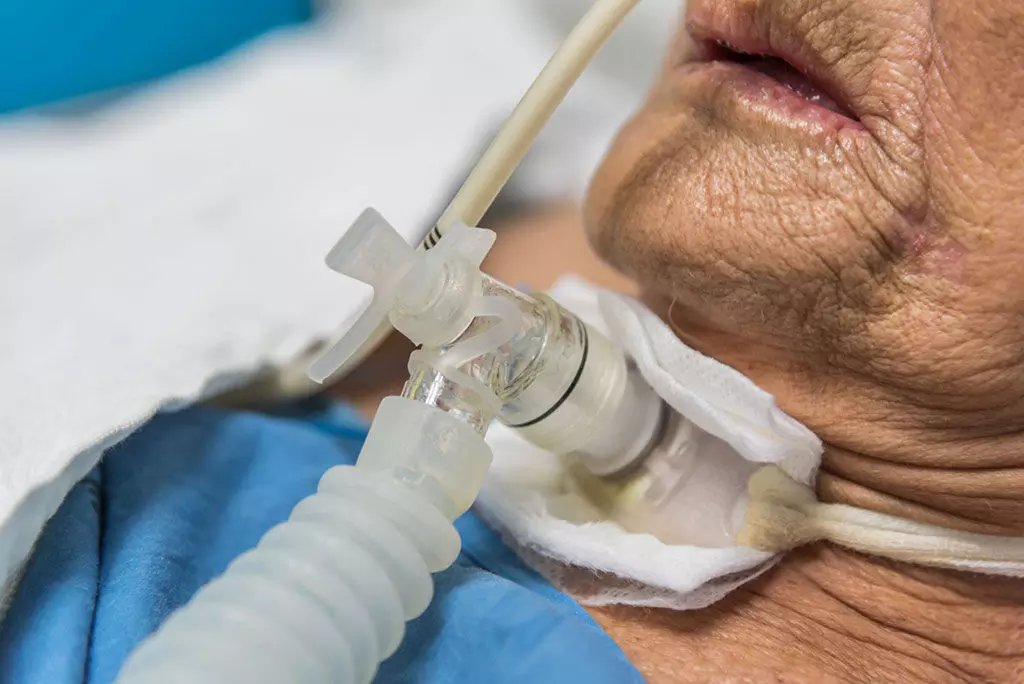 Early Intervention in Laryngeal Injury After Intubation reduces risk of tracheostomy,JAMA