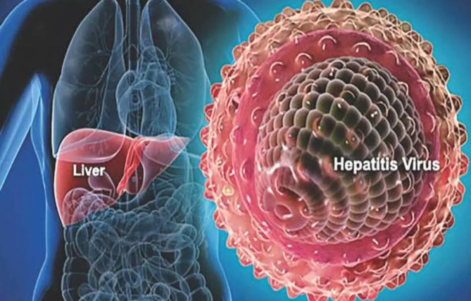 The AGPR Index - novel non-invasive marker in Chronic Hepatitis B