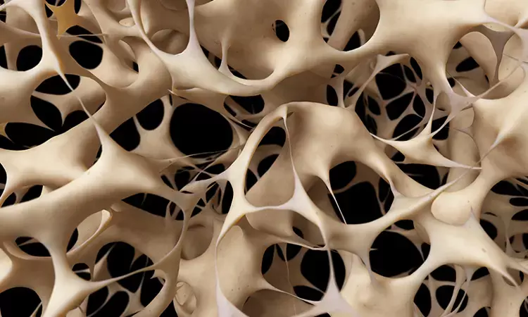Men with high levels of body fat may be at risk for osteoporosis