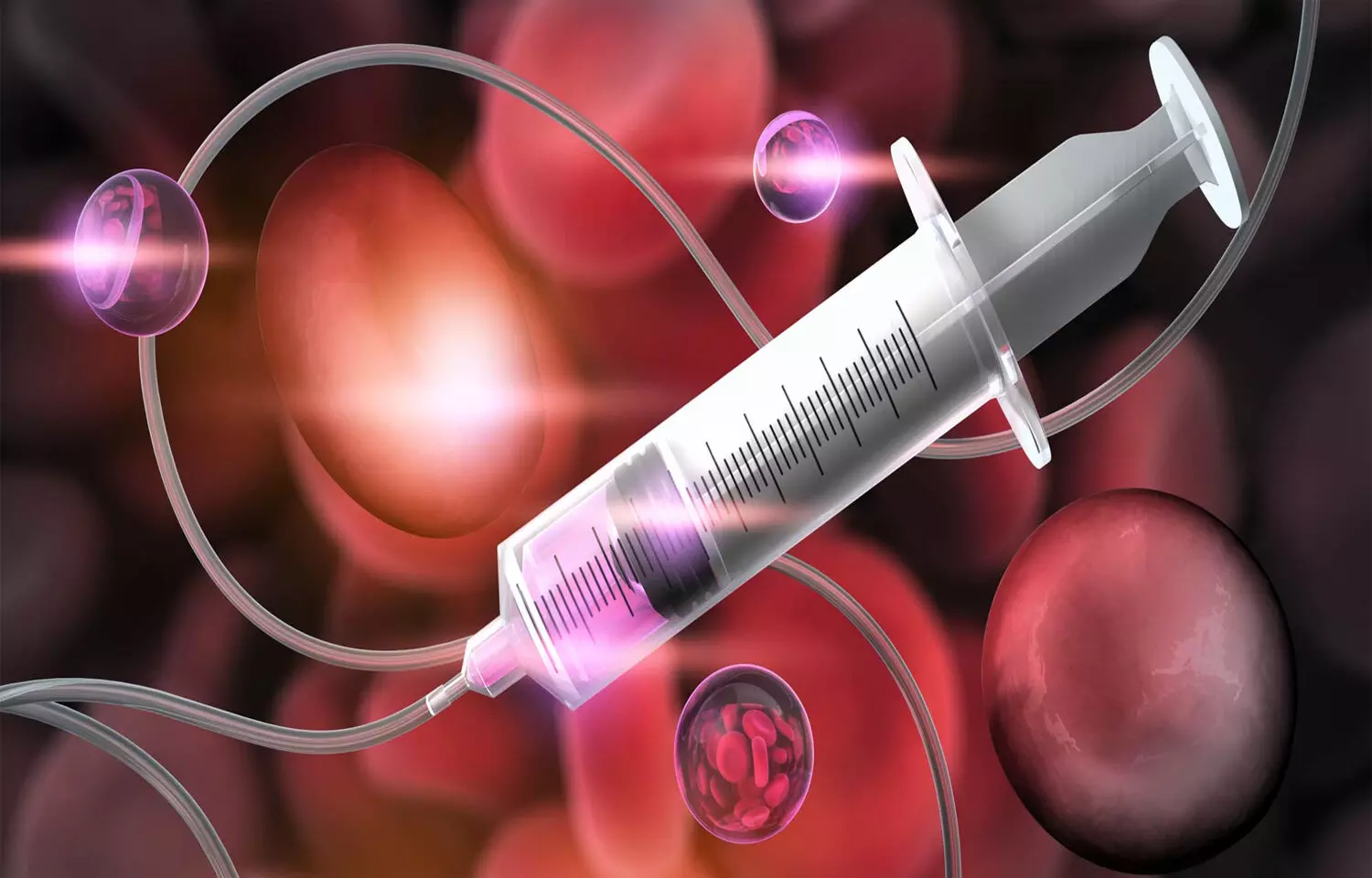 Use of intravenous tranexamic acid not linked to thromboembolic events: JAMA