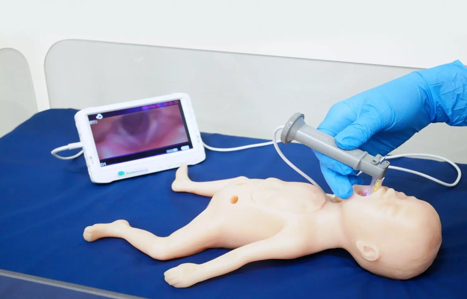 Video laryngoscopy in infants facilitates orotracheal intubation in first attempt: Study
