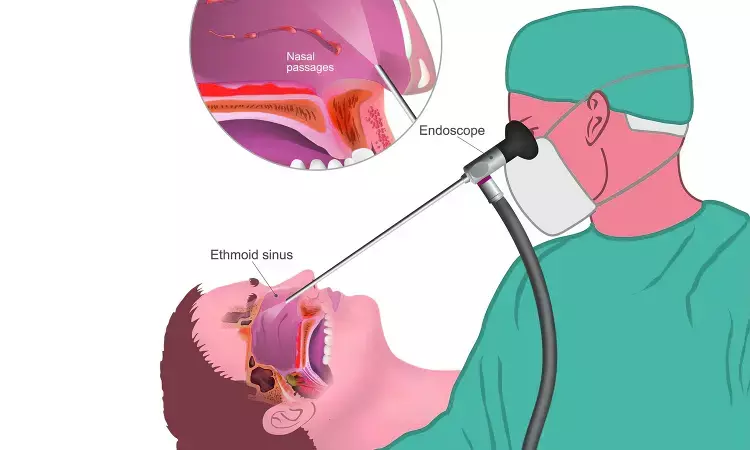 Flexible laryngoscopy not significant aerosol-generating procedure in real-time clinical setting