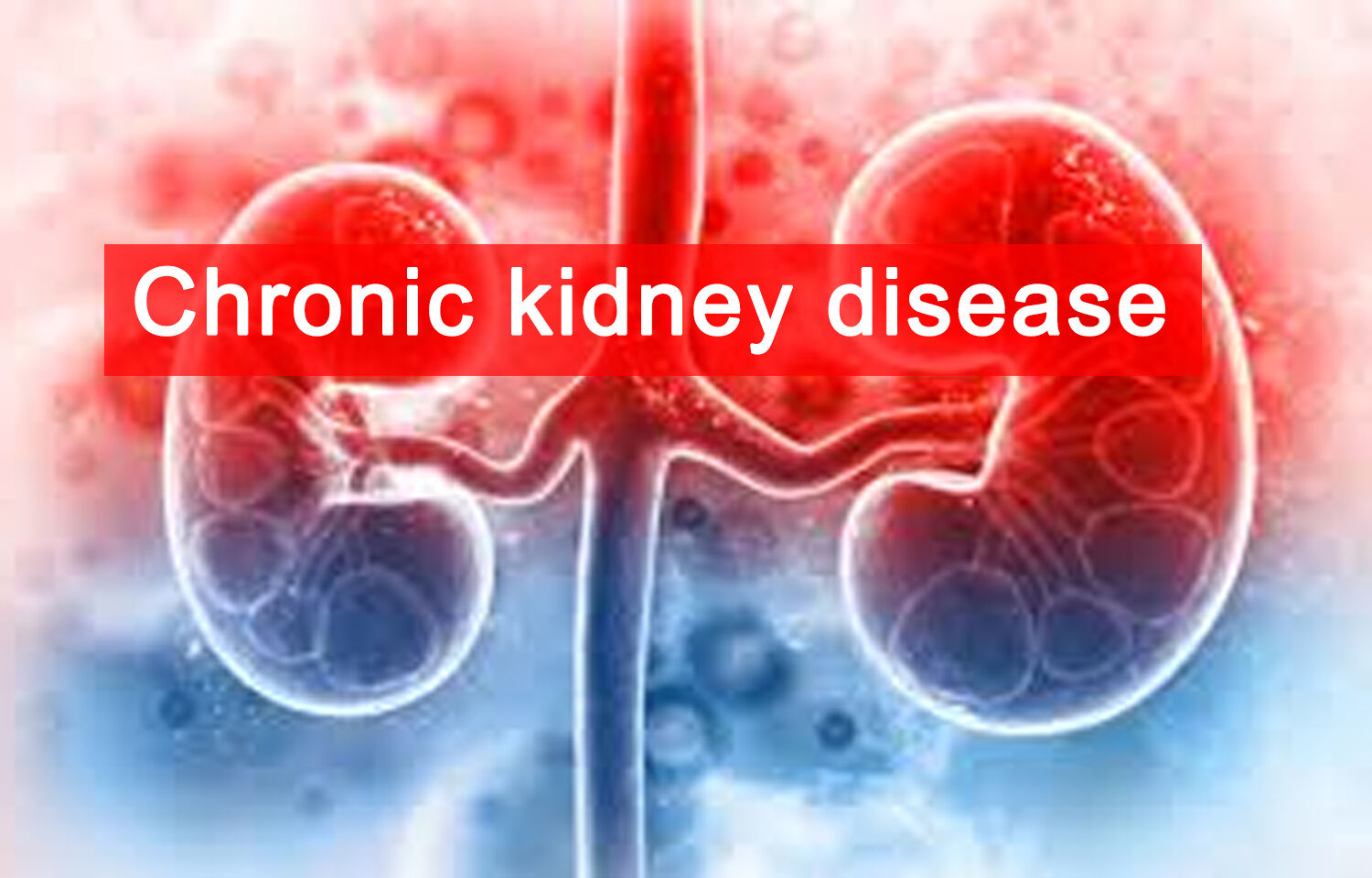 research articles on chronic kidney disease
