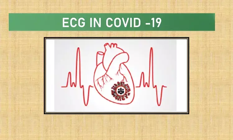 An ECG at admission can predict COVID-19 outcomes, reports study