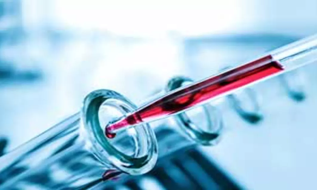 Blood test holds great promise for detecting serious placental disorder
