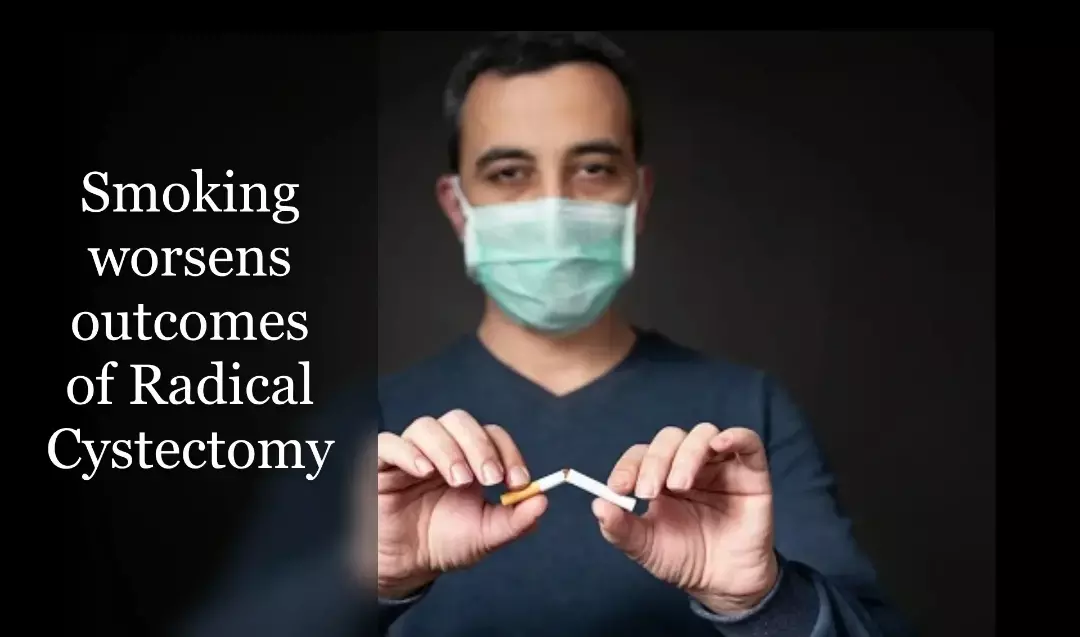 Smokers at increased risk of complication after Radical Cystectomy