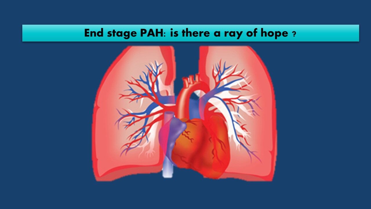 Ray of hope for end stage pulmonary hypertension: Pott's shunt