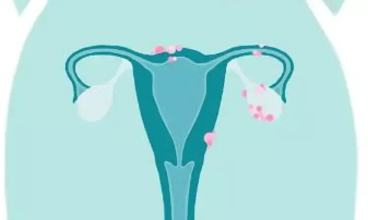 Aggressive treatment beneficial for Older women with ovarian cancer; finds study
