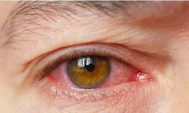 Artificial tears can alter keratometry measurements in dry eyes patients