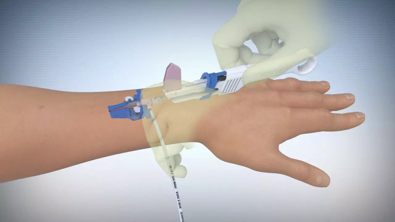 Long Peripheral Catheters first-line device for for Multiday IV Therapy in kids: Study
