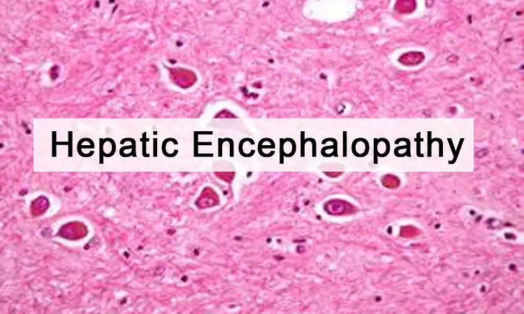 Rifaximin may prevent hepatic encephalopathy after TIPS in patients with cirrhosis
