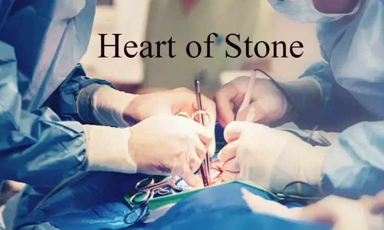 GMC doctors find HEART of STONE on autopsy of a 50-year old- case report