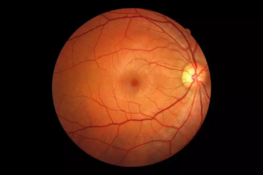 Difference between retinas biological age and persons real age linked to heightened death risk