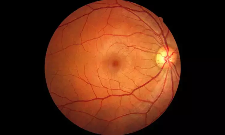 Increased choroidal thickness in macular commotio retinae tied to decreased visual acuity