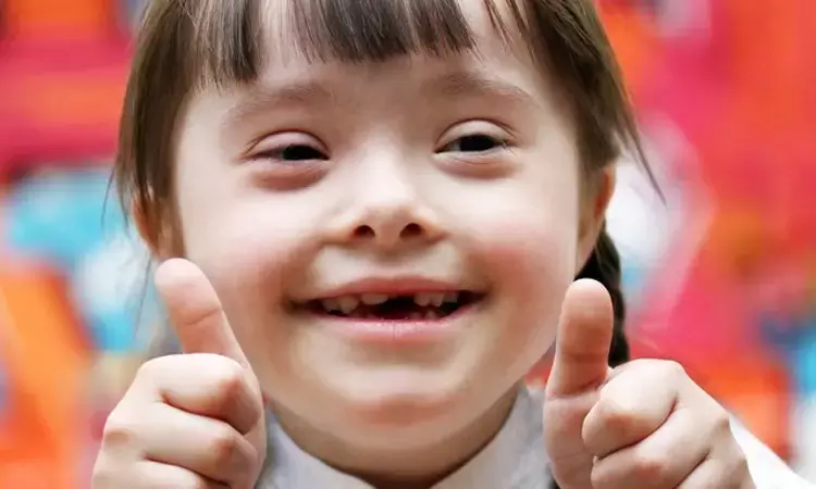 Arytenoid obstruction in children with Downs syndrome tied to adenotonsillectomy failure: JAMA