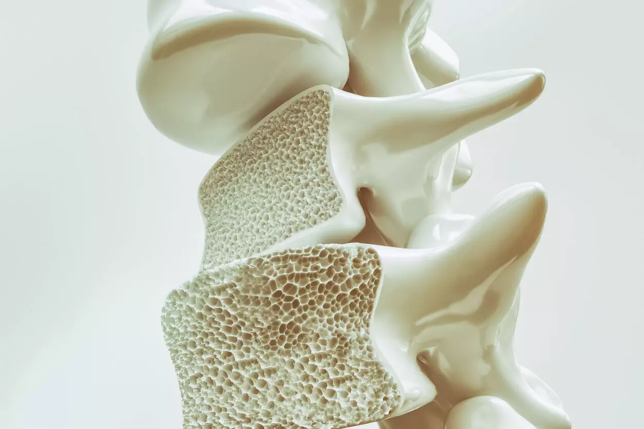 Lithium Treatment decreases Osteoporosis risk in Patients with Bipolar Disorder: JAMA study