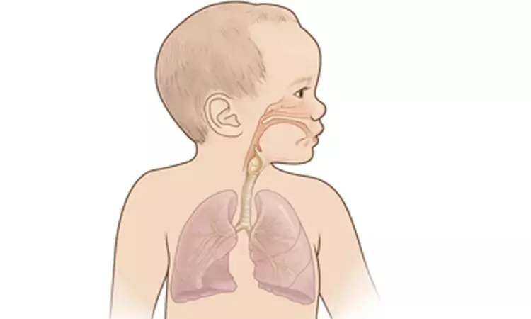 In Preterm babies, Lung ultrasound scores useful to predict Bronchopulmonary dysplasia: Study