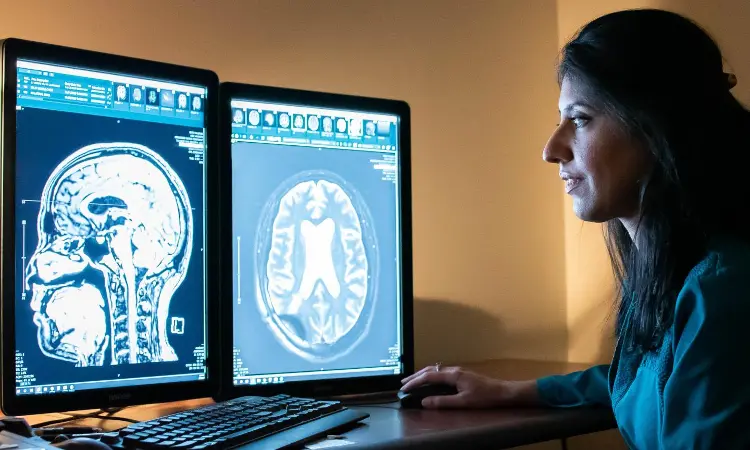 Transcranial direct current stimulation improves post-stroke dysphagia: Study