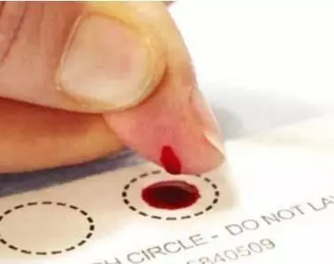 Dried Blood Spot a potential low-cost option for neonatal CMV screening; JAMA