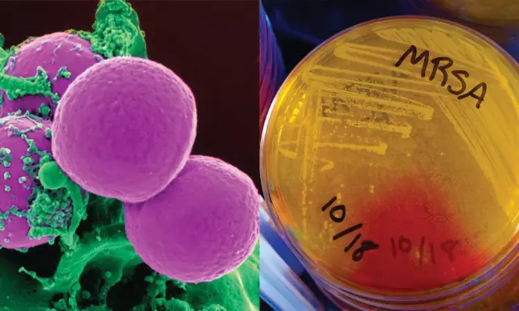 Management of MRSA infections: Updated UK Guidelines