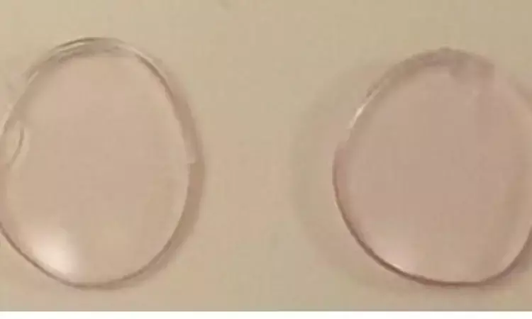 Researchers develop contact lenses that may correct Color blindness