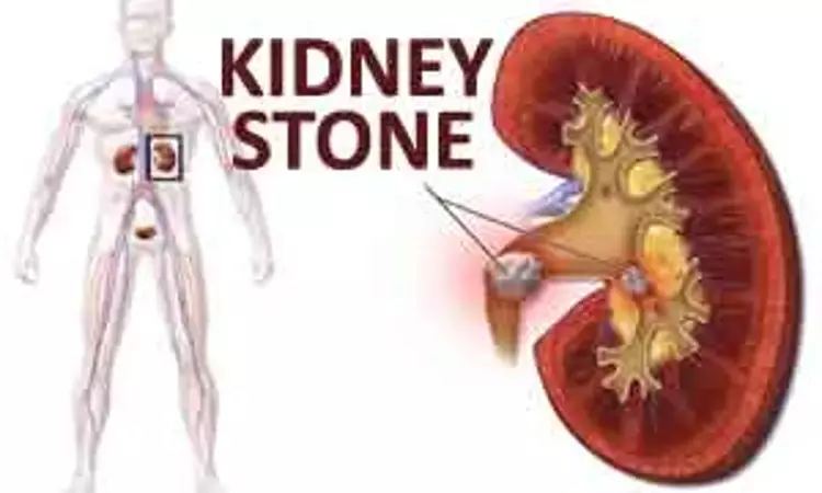 Reduced-dose CT effective for imaging of kidney stones: Study