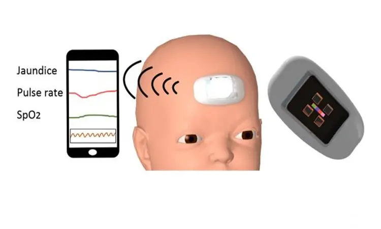 First wearable device can monitor  bilirubin and vitals in newborns: Study
