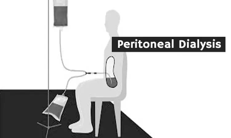 Peritoneal Dialysis is significantly improving patient outcomes: Experts