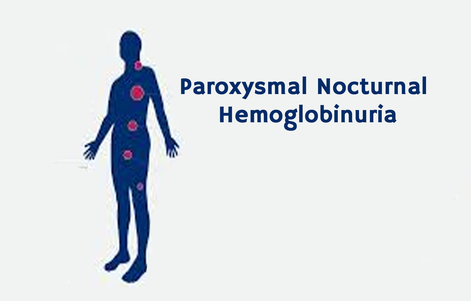 paroxysmal nocturnal dyspnea medical term