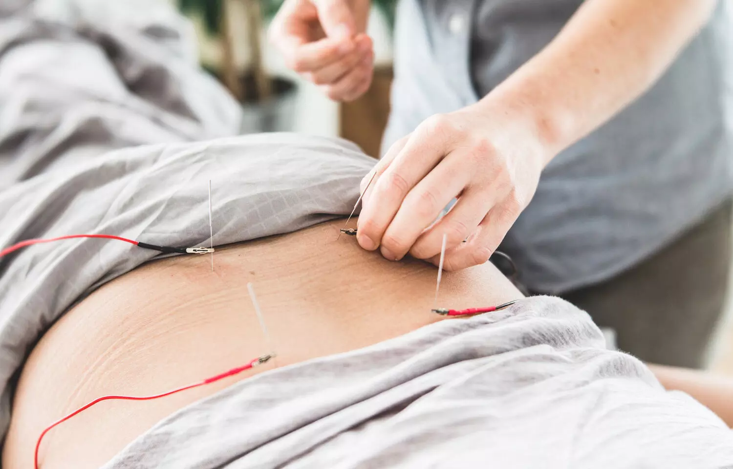 Different modalities of accupuncture reduce chronic pain in cancer survivors: JAMA